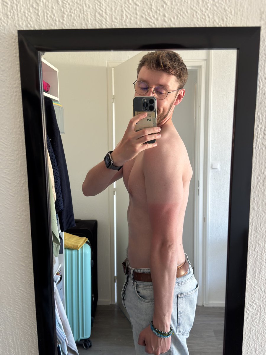 RomainBance's tweet photo. J’en ai même la marque du cycliste 🫠🥲 https://t.co/fV0PziP4GU