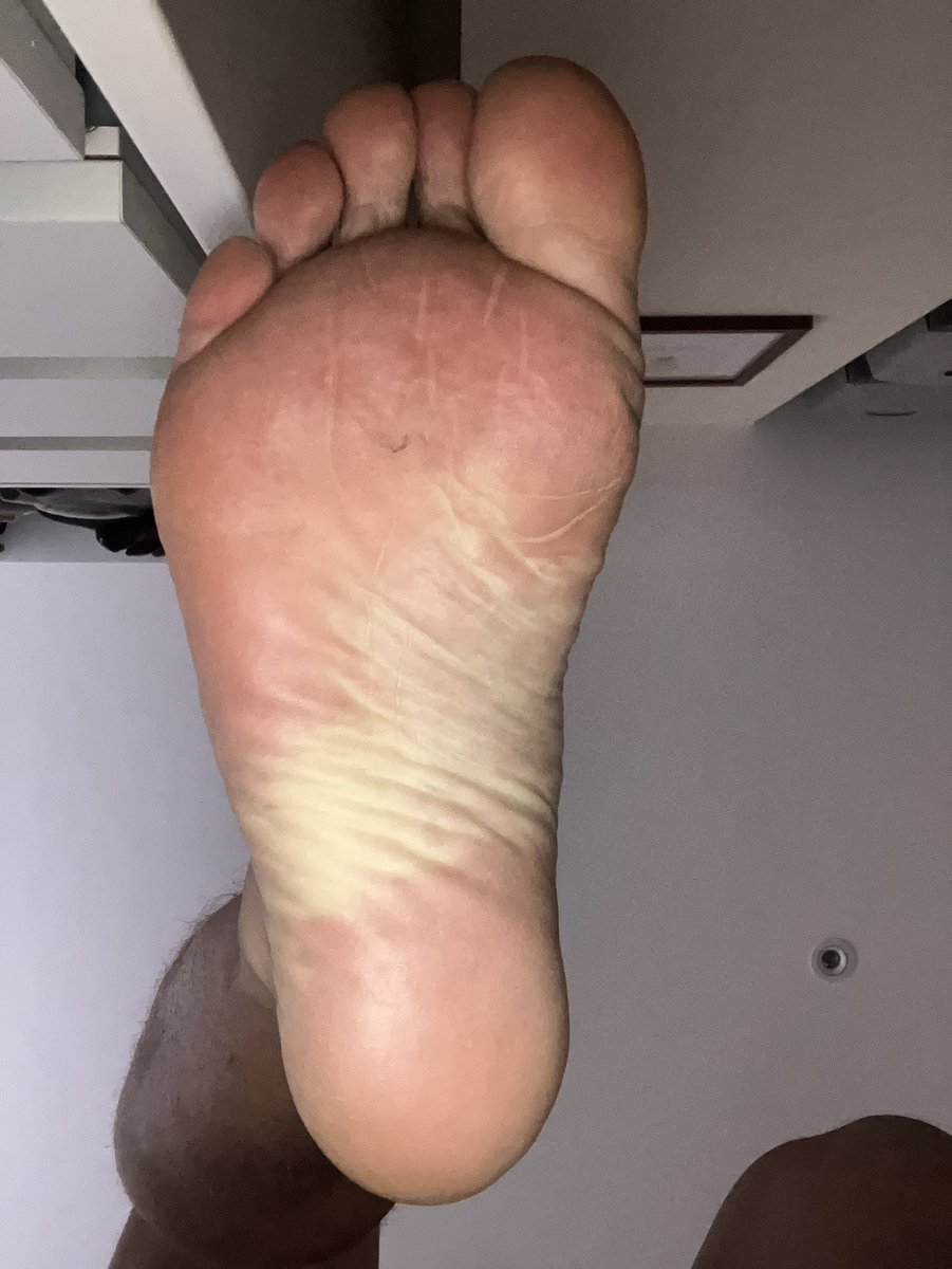 Essex_feet_Ben tweet media