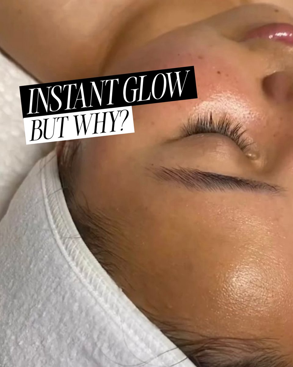 BeautyStyleHH's tweet photo. Hydrafacial Hamburg ✨
Warum sieht deine Haut danach sofort besser aus – Zufall oder Methode?

👉🏻 Lies es im Blog: https://t.co/BPeEmWDI5d

#Hydrafacial #Hamburg #Skincare #GlowUp https://t.co/HA2o3n5KK0