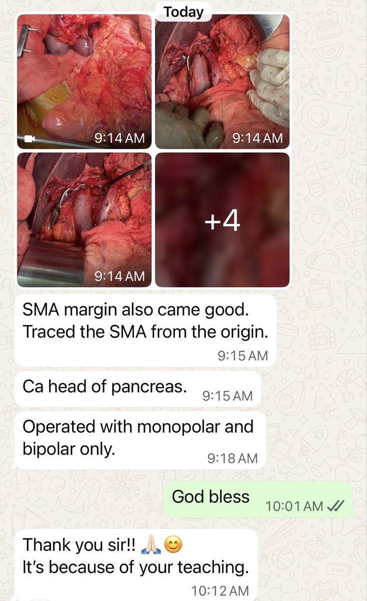 Shrikhande_SV's tweet photo. A surgeon I have trained. This is not about credit but continuity.
To really improve pancreatic cancer care, we must be serious about training more surgeons beyond cities. A surgeon’s legacy is not only in the patients he operates but in those he shapes &amp; the patients they serve! https://t.co/JxfCvo8SQa