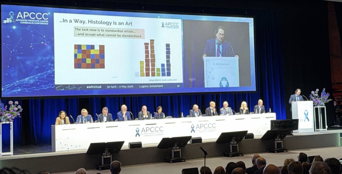 RodRogSan's tweet photo. 🎯Histopatología en el cáncer de próstata de alto riesgo y localmente avanzado, identifiquemos el componente Cribiforme @APCCC_Lugano
#IPCS26 #APCCC26 @urotoday @aaoncoclinica @OncoAlert  @GrupoGuiaArg @oncourologiaarg https://t.co/5GSv4KBCPJ