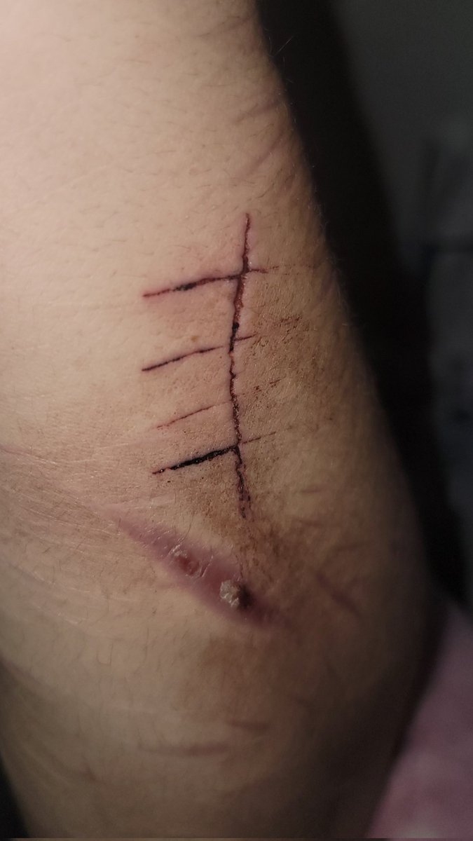 ATTICUS | shedtwt tweet media