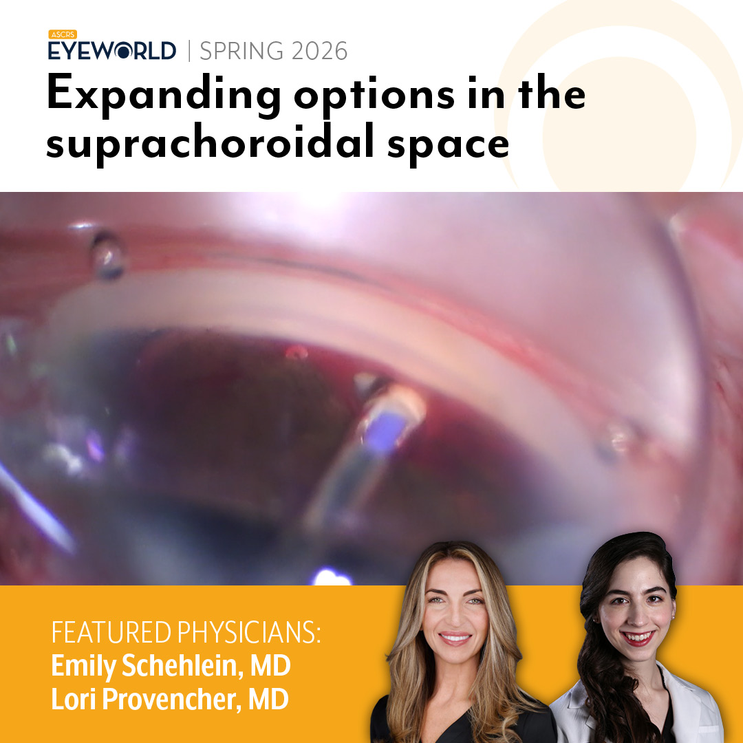 ASCRStweets's tweet photo. Is the suprachoroidal space the next frontier in IOP reduction?
Emily Schehlein, MD, and Lori Provencher, MD, explore why this pathway deserves renewed attention.
Dive into the discussion https://t.co/ubG6aCD8VG
#GlaucomaSurgery #IOPControl #Ophthalmology #EyeWorld https://t.co/jL7MrP2S0z