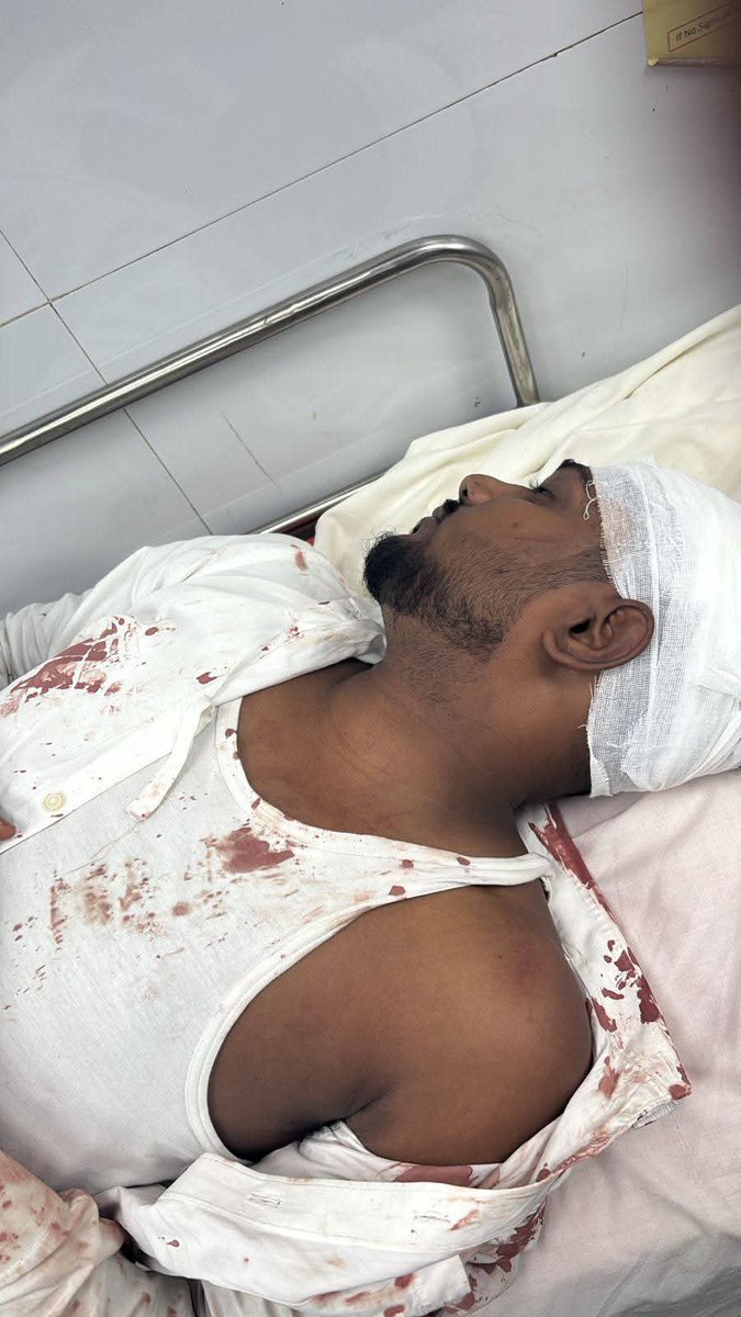 otvnews's tweet image. #Bhubaneswar | Two students injured in a violent clash at BJB College in Bhubaneswar over passing of comments.

The situation has caused intense tension on campus. #Odisha