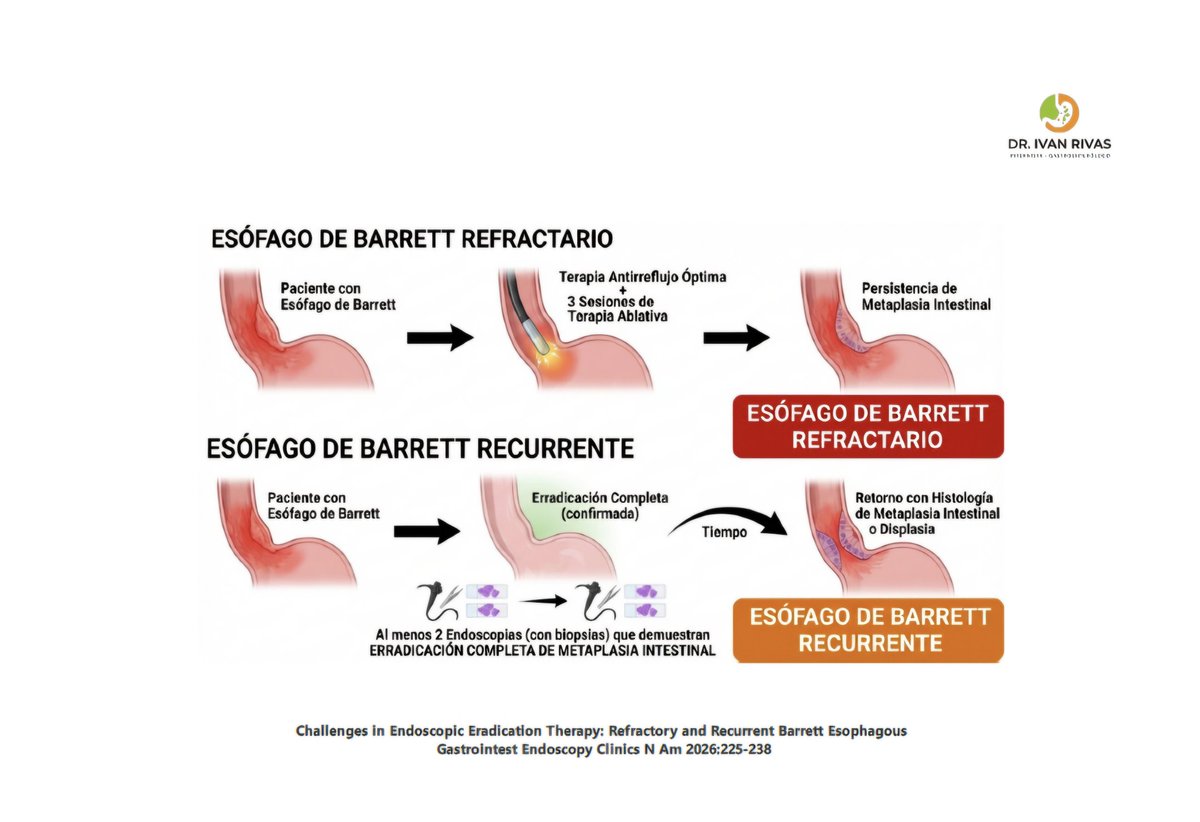 Ivanri's tweet photo. Esofago de Barrett recurrente?
https://t.co/Ou9d0PLqvi https://t.co/nVCpf8CRuv