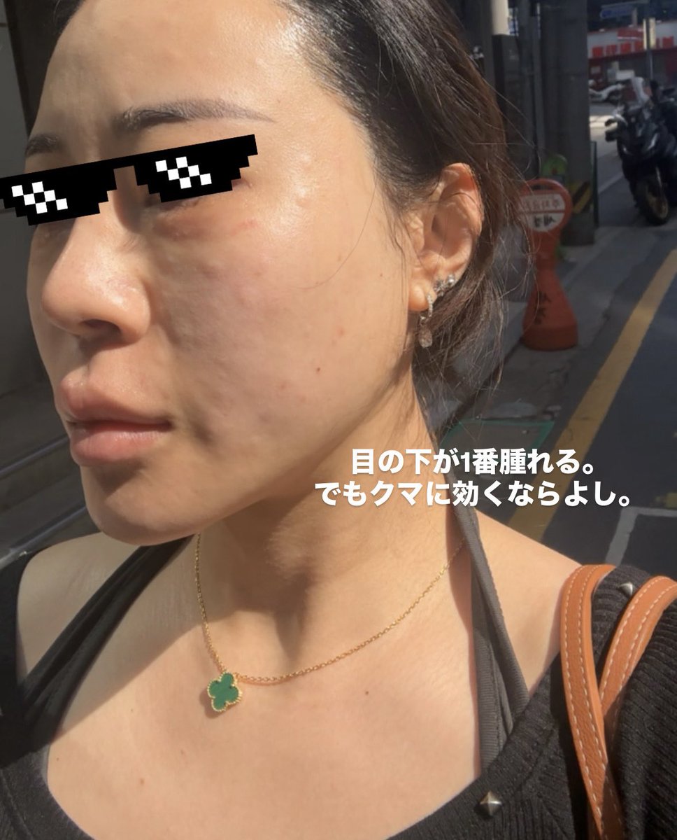 とうがらし ペリカンDT tweet media