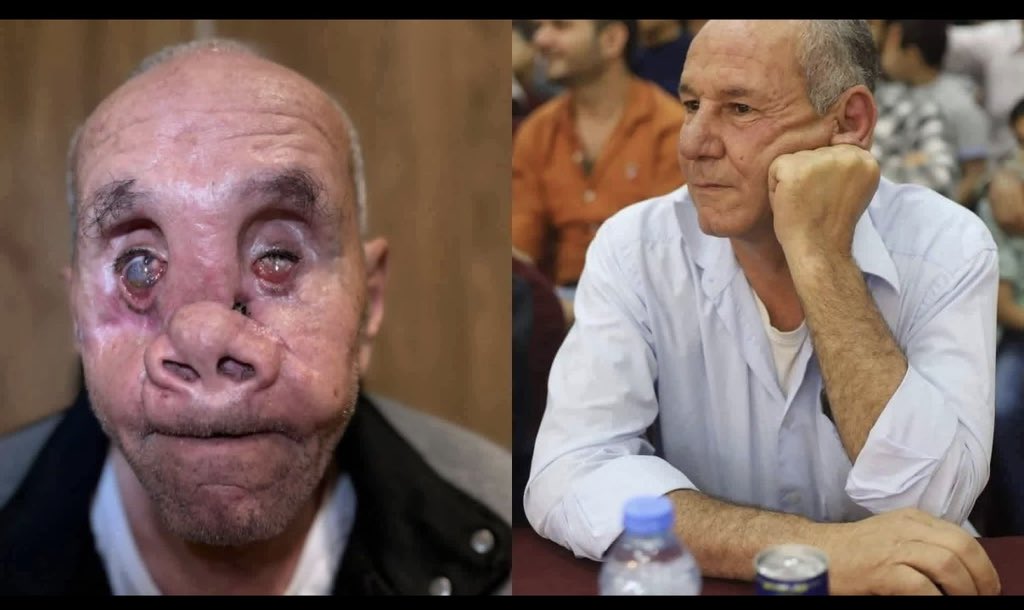 LadyVelvet_HFQ's tweet photo. A Palestinian prisoner… and no explanation could ever match what these images reveal. They carry the weight of suffering far beyond words — a body broken, a spirit tested in ways most cannot comprehend. This is not just pain; it is the slow, deliberate erosion of a human being inside prison walls.
The contrast between the two photos is unbearable. Before imprisonment, a man full of life. After… a shadow, marked by deprivation, torment, and the silent violence of time spent in captivity. Every detail tells a story of what was taken from him — physically, emotionally, and psychologically.
And yet, in the face of this, there are still claims of “humanity” and “human rights.” These images challenge those words, exposing a reality that stands in stark contradiction.