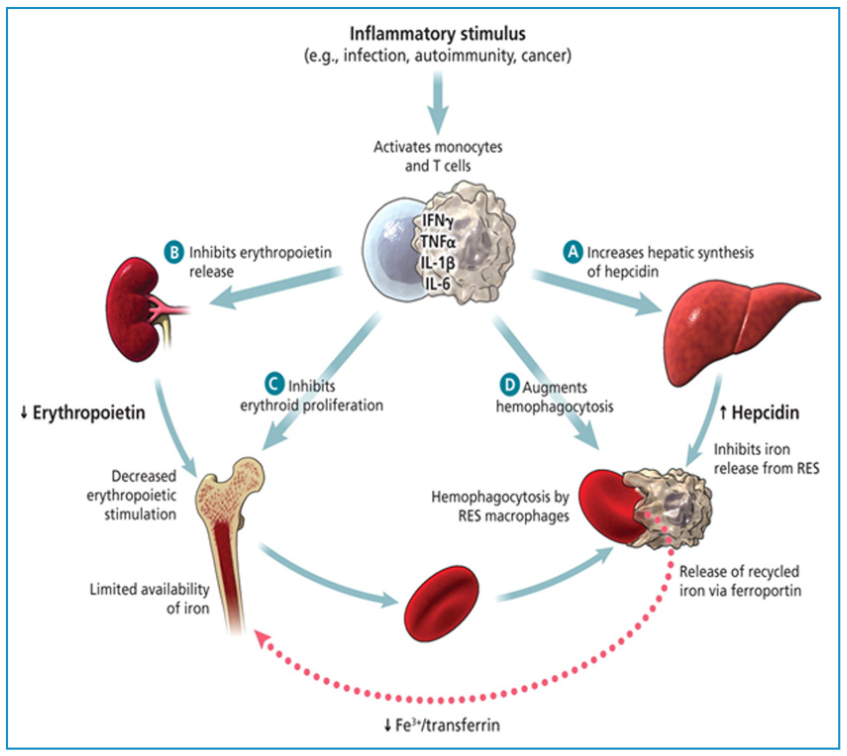 CritCareReviews's tweet photo. Today's Paper of the Day is:

Anemia of Critical Illness: A Concise Definitive Review in Critical Care

https://t.co/JKgcYjlUQ5

Join us to read 1 paper per day and stay up-to-date as we cover the spectrum of critical care across 2026 https://t.co/TzN5xLHUKf