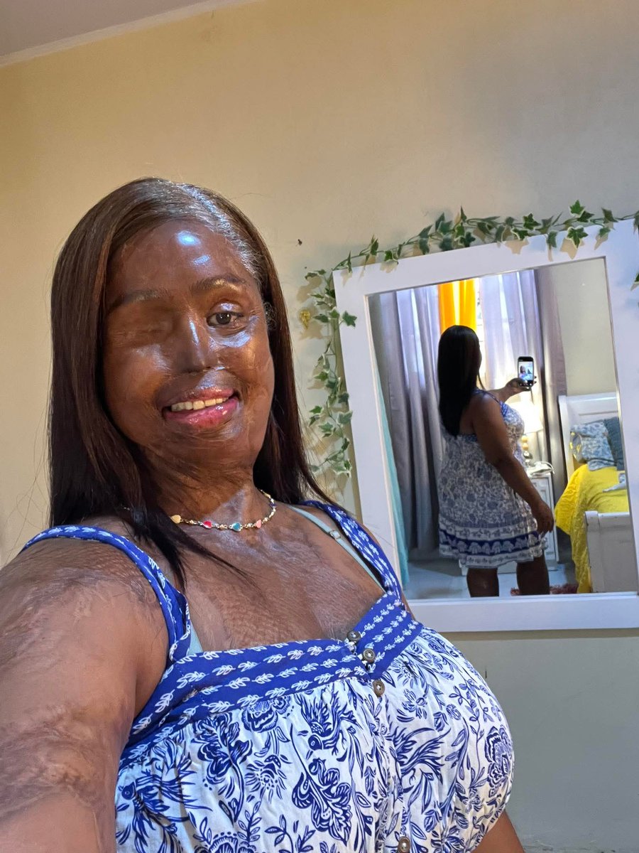 Done 43 chemo 
I Am cancel free 🌹🥰