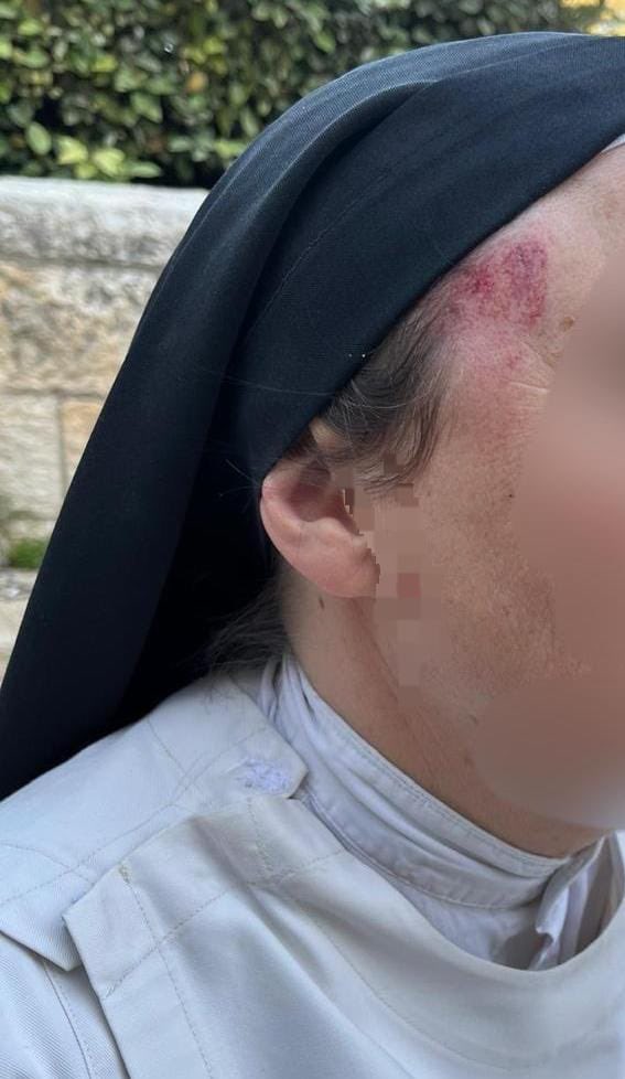 RT_com's tweet photo. 'Extremist Jew' attacks nun in Jerusalem

A lecturer at a French school was punched in the face and shoved hard. The 36-year-old attacker then ran off

Israeli police have already arrested the suspect

Source: Channel 13 correspondent Yossi Eli https://t.co/KHxnCuhI9b
