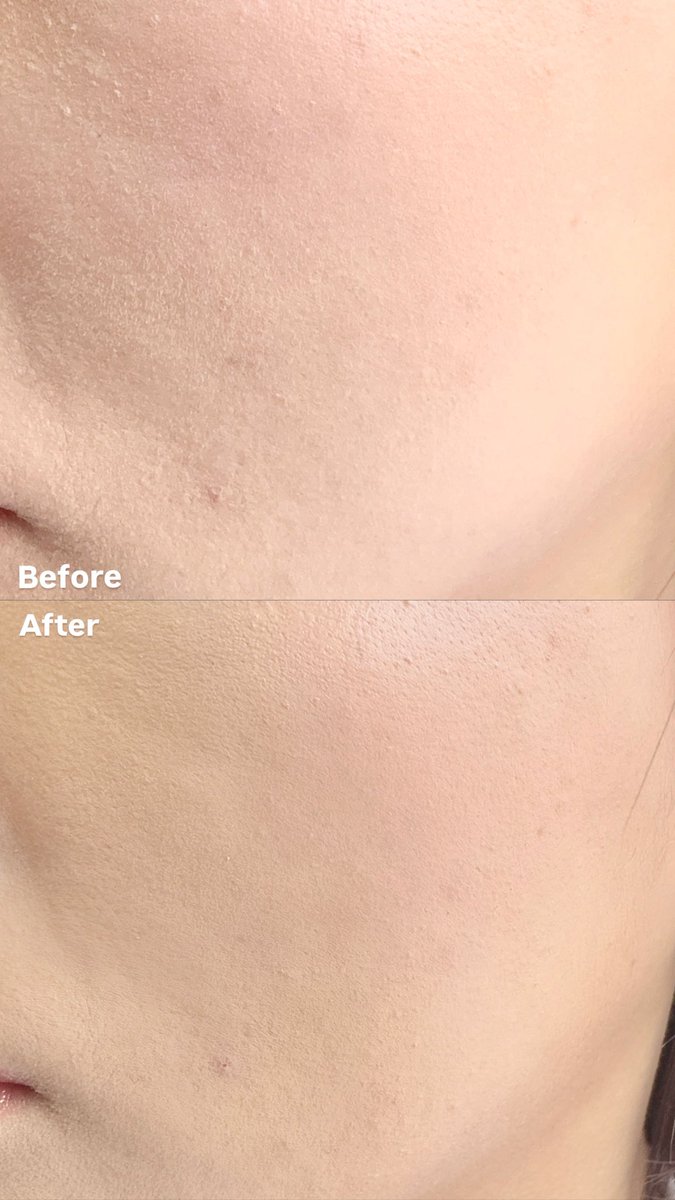 𝑺𝑾𝑰𝑰𝑵𝑮 tweet media