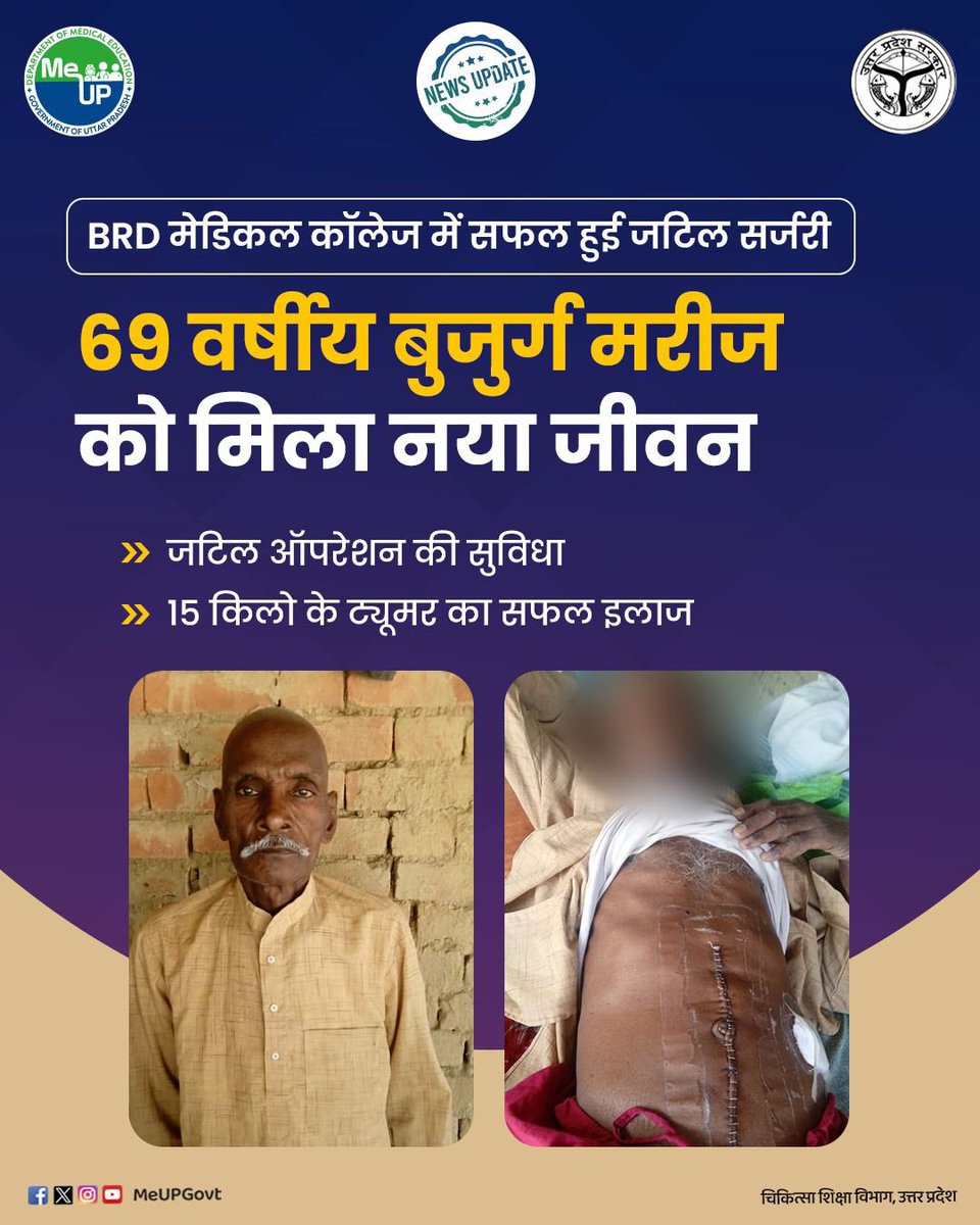 MeUPGovt's tweet image. BRD मेडिकल कॉलेज में सफल हुई जटिल सर्जरी , 69 वर्षीय बुजुर्ग मरीज को मिला नया जीवन।

* जटिल ऑपरेशन की सुविधा।
* 15 किलो के ट्यूमर का सफल इलाज।

#BRDMedicalCollege #Gorakhpur #SurgerySuccess #Healthcare #NewLife #DoctorsOfIndia