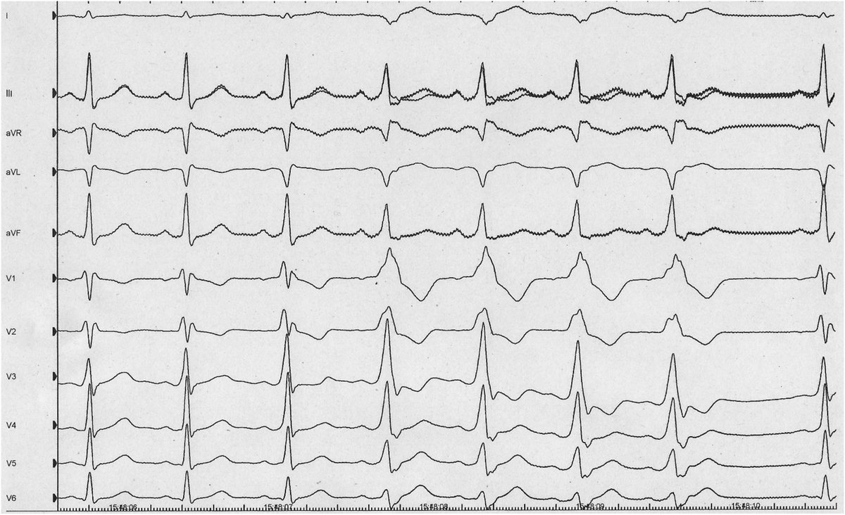 European Society of Cardiology Journals tweet media