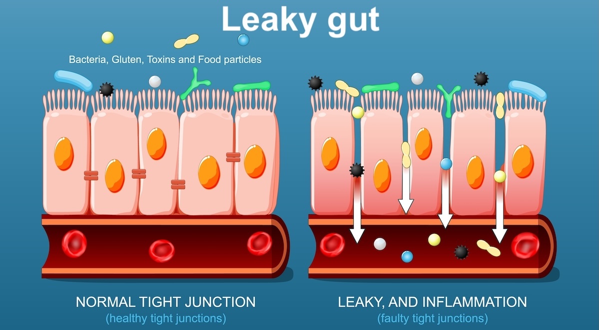 GMWatch's tweet image. Herbicide cocktail used in #GMO agriculture causes leaky gut. Landmark study on #glyphosate, 2,4-D and #dicamba shows so-called safe exposure levels are not safe when absorbed as a mixture gmwatch.org/en/106-news/la…