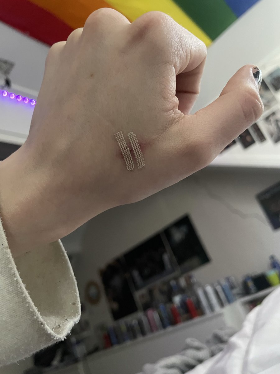 Ncity1270000's tweet image. Fucking bullshit I had to do so this stupid MINI styro can actually heal bc it tripled in size bc I kept picking at it. And it got those red lines a few times💔
#shtwt #fml