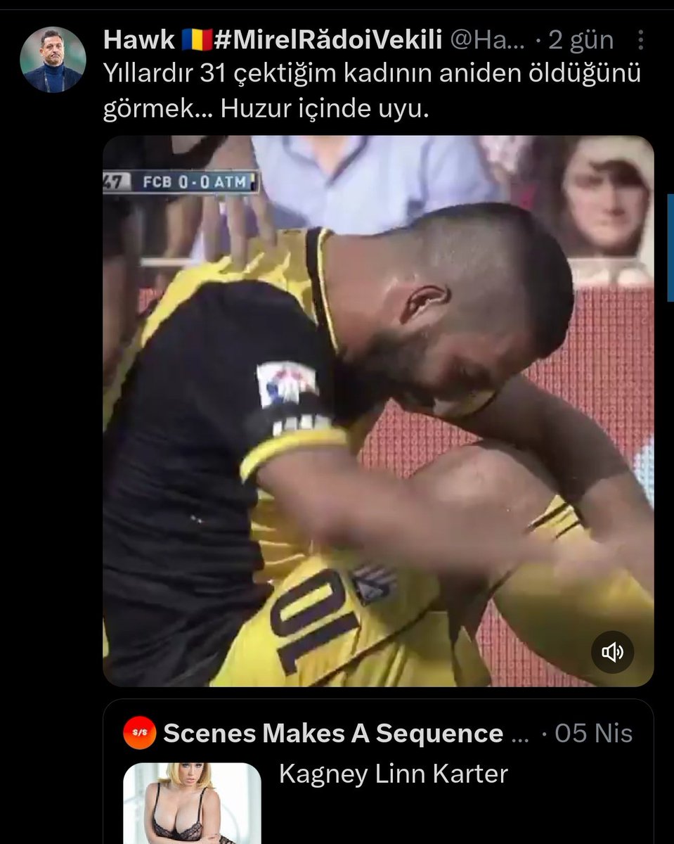 Guts🇹🇷 tweet media