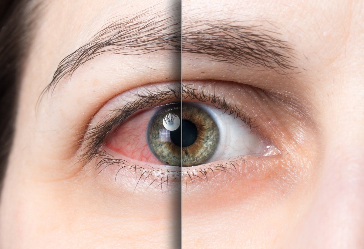OptometricManagement tweet media