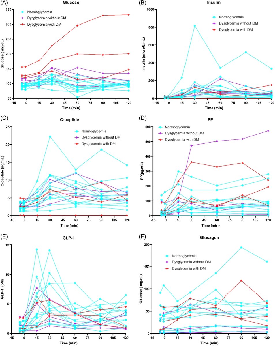 JPGNonline's tweet image. Diabetes risk in pediatric pancreatitis is often underrecognized.

In this pilot study, 35% had dysglycemia, all with insulin resistance.

Signals of impaired insulin secretion and hormonal changes add to the picture.

More to uncover here.
doi.org/10.1002/jpn3.7…

#pediatrics #p