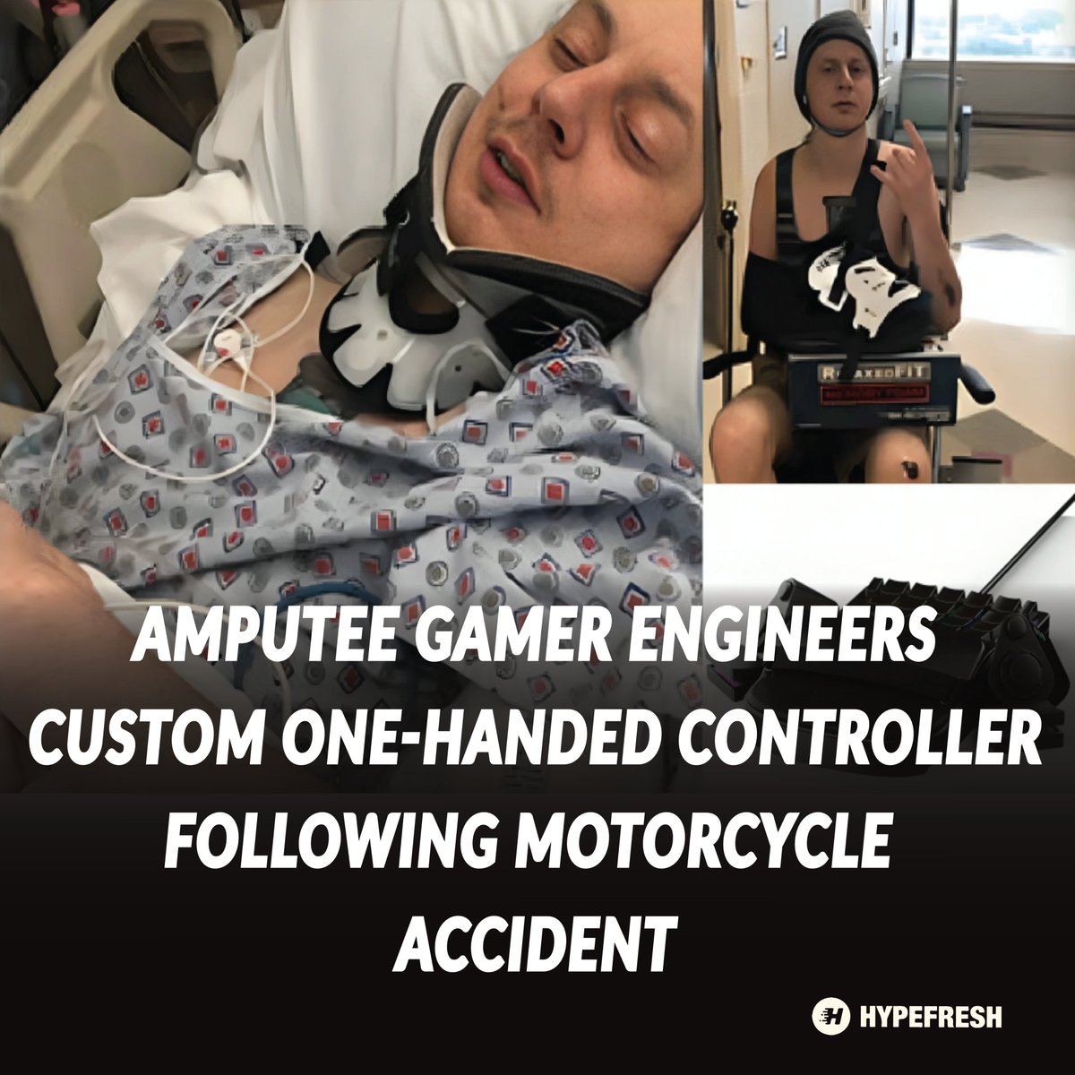 HypefreshC's tweet photo. Gamer loses arm in motorcycle crash, engineers custom one-handed controller. Proves disability can’t stop passion. Innovation meets resilience.

#GamingWithoutLimits #AdaptiveTech

🔗 Tap to see more – https://t.co/eob7iP3TqN https://t.co/T0I1ahrZ6y