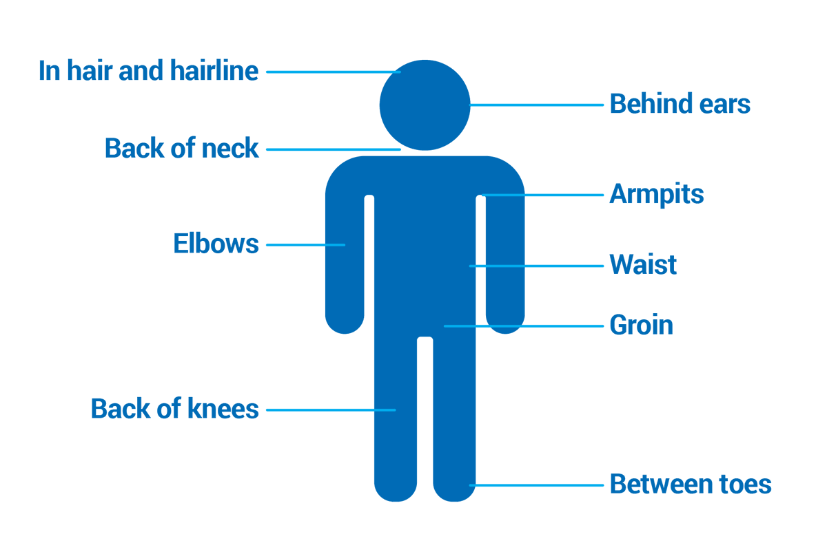 HikeNS's tweet photo. Be tick safe when hiking! Check all these spots after your hike. https://t.co/5gkwGWELjR https://t.co/Ev4zOXrRuh