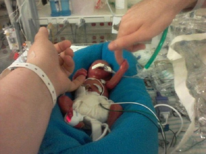 LifeNewsHQ's tweet photo. 17 babies who were born alive after botched abortions in Alberta were left to die.

That's just in 2025.

The Canadian Institute for Health Information reported the 17 cases of  infants born alive after induced abortions in acute care hospitals. The figures are tracked under the discharge code for “Termination of pregnancy, affecting fetus and newborn.”

Alberta Health Services policies permit withholding resuscitation and active care from these newborns, treating them differently from other premature infants solely because they survived an abortion.

28 babies were left to die after botched abortions in 2024. 

20 babies were left to die in 2023.

This is infanticide and it must be stopped NOW.

Every child born alive deserves the same standard of care -- whether they were destined for abortion or birth.