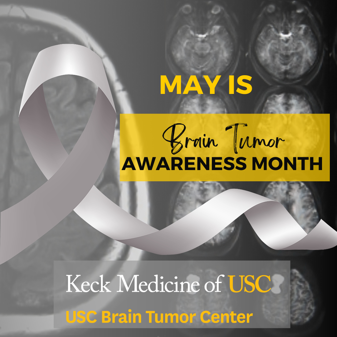 USC Brain Tumor Center (uscbtc) tweet media