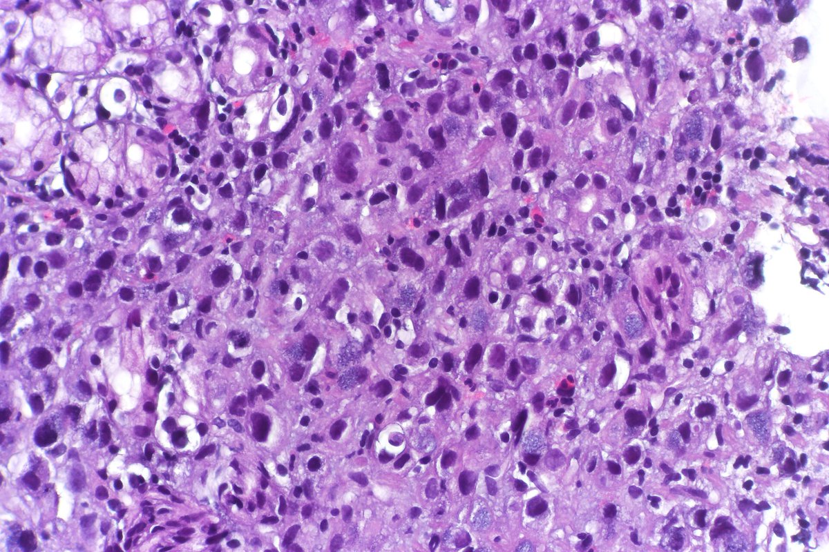 Extracellular Matrix News tweet media
