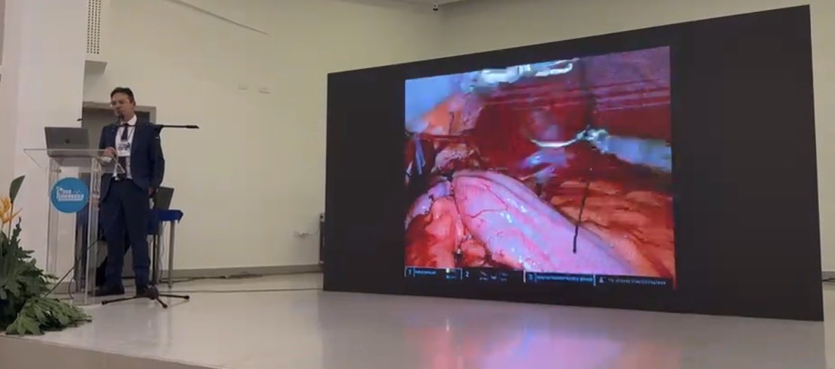 juliomayol's tweet image. Brillante presentación en el #foroquirugicodelcaribe con una técnica robótica extraordinaria. ¡Enhorabuena! #some4surgery
