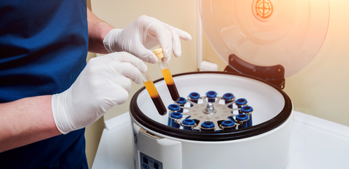 drapeldds's tweet image. Enhance recovery after your procedure with L-PRF. Reduce recovery time and improve results after dental implants or extractions! #melbourne #florida #dentalimplants #dentist bit.ly/4ikqIhY