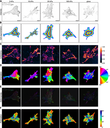 CytoskelJournal's tweet image. Have a look at this new #openaccess #research #article in #CYTOSKELETON: Talin1 Adhesion Morphology and Colocalization With Tensin3 Are Largely Unaffected by Polyacrylamide Substrate Stiffness. Read it here: onlinelibrary.wiley.com/doi/10.1002/cm…