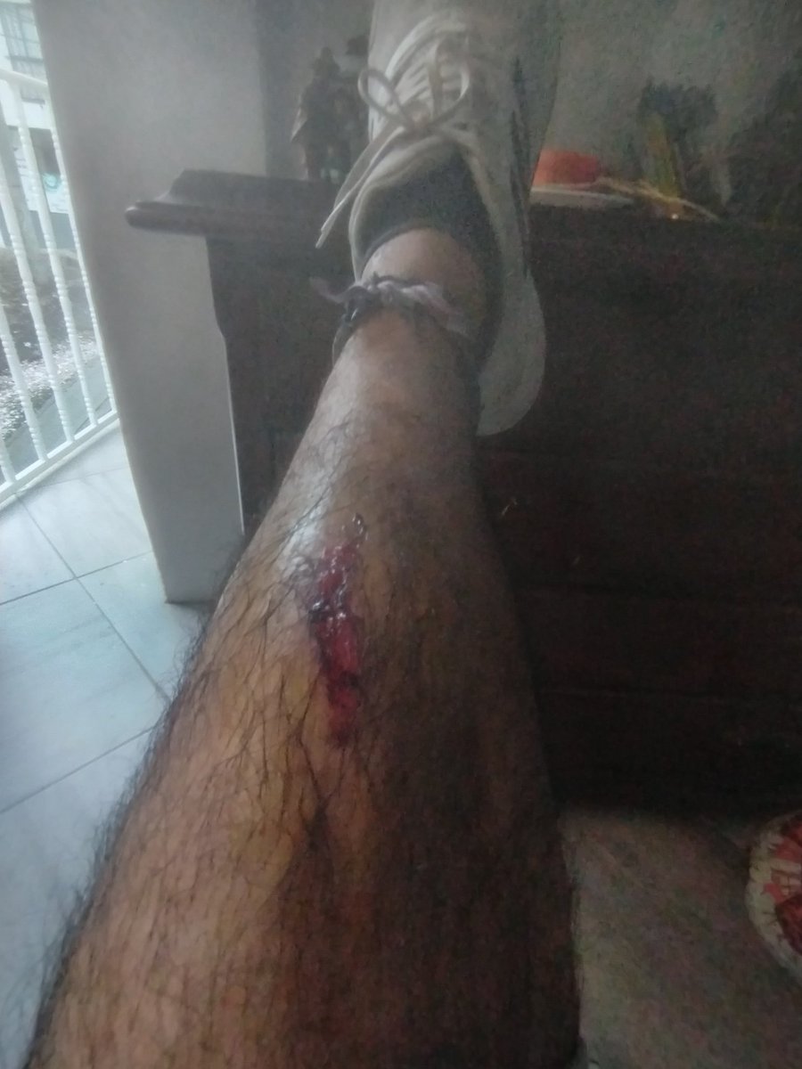 Esto me pasa por inquieto