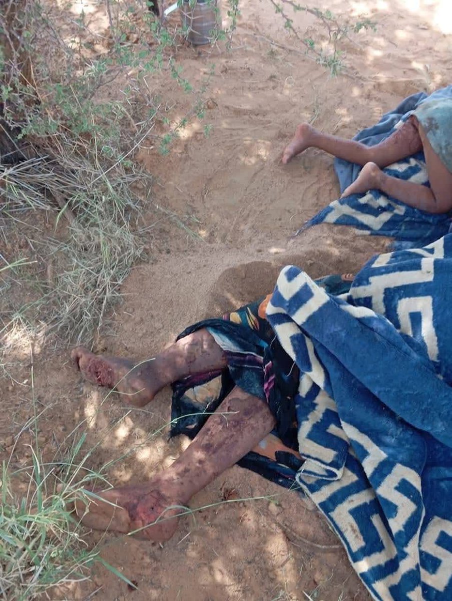 AgAnchawadje's tweet photo. @UNICEF @OCHA_Mali, je voudrais savoir où vous étiez quand nos populations dont des femmes et enfants étaient massacrées. C'est ce soir vous sortez parce que des jeunes gens bien on fait malheureusement l'erreur de se filmer avec un enfant dans une vidéo à des fins sarcastiques que vous surgissez comme si nos enfants n'étaient pas humains eux