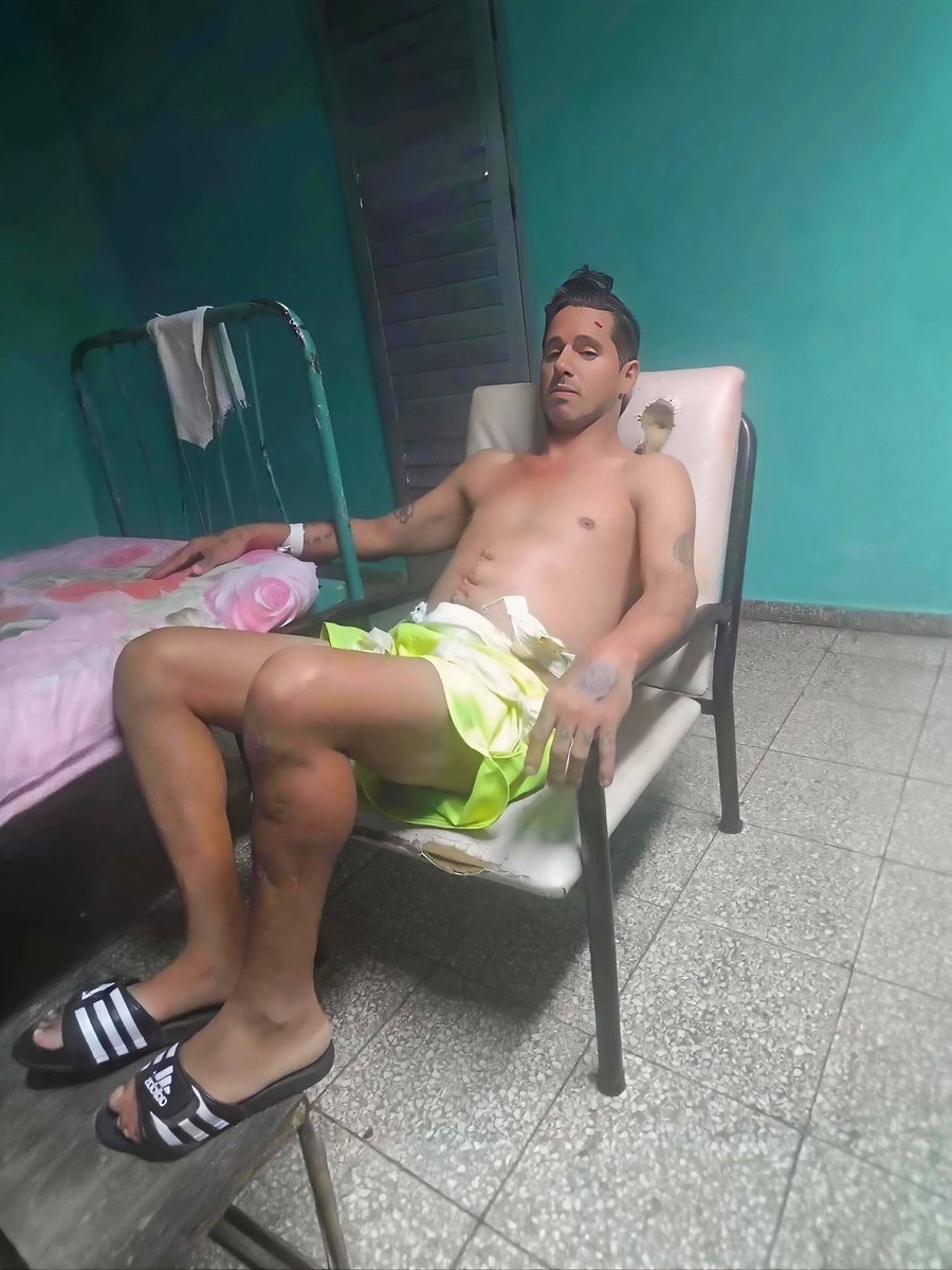 Joven operado de la vesícula en el Hospital General de Guantánamo. La flotilla de idiotas que estuvo en Cuba hace poco solo tuvo tiempo para tirarse fotos y repartir tres maletines de mierda. Ah, y para pasear y comer en sitios vedados para el bolsillo del cubano.

¡Yo me cago en