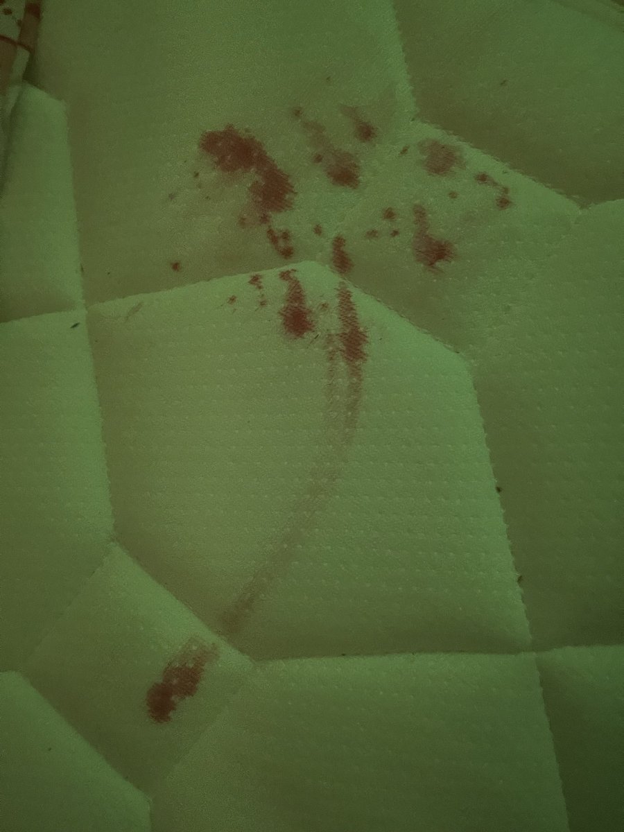 mimi81ww's tweet image. help me👀
i didn’t know my thigh was still bleeding and it got on my bed😴 
HOW DO I CLEAN THIS👀
#shedtwt #shtwt #helpme