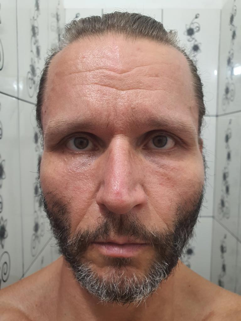 SalomonRejuven's tweet image. 💥 I found the fountain of youth of the emperors.
Day 4520. Age 53 → reversing into low 40s.
No filters. No shortcuts. Just biology reactivated.
Goal: 25.
I post daily until I get there. Watch closely.
💪
#RejuvenationBodybuilding #ReverseAging #Longevity #Shredded