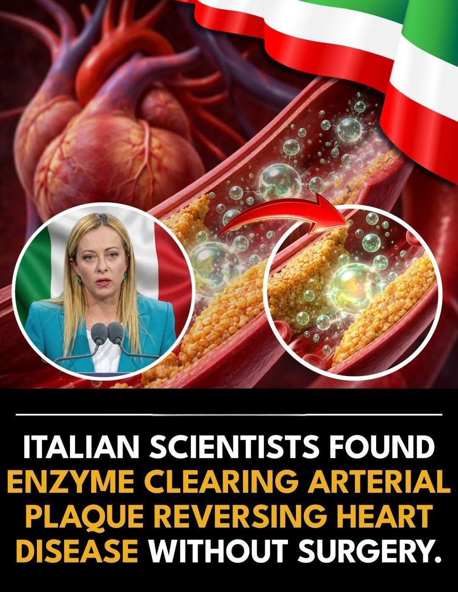 Wolf_India360's tweet photo. #Researchers at the #UniversityofMilan have identified that an #enzyme called #phospholipid transfer protein (PLTP) can effectively mobilize cholesterol from #arterialplaques, sending it back into the #bloodstream for natural disposal. This discovery is a potential game-changer because, unlike current treatments that primarily focus on preventing new plaque from forming, this method actually targets and dissolves existing blockages.

#Atherosclerosis occurs when #cholesterol and #inflammatorycells create stable, hardened deposits in artery walls that resist traditional removal methods. When these plaques become too large, they severely restrict blood flow, often necessitating invasive procedures like stents or bypass surgery to prevent heart attacks or strokes.

The #PLTPenzyme acts as a natural extraction system, pulling cholesterol out of the arterial wall and transferring it to HDL, or "good cholesterol," for transport to the liver. Scientists found that many people have naturally low levels of this activity due to genetic factors, which is why they have developed a gene therapy to boost PLTP expression directly where it is needed most.

In animal models, this localized boost in enzyme activity resulted in a 40% reduction in plaque volume in just three months, allowing narrowed arteries to reopen to nearly their original diameter. These results suggest that plaques not only become smaller but also more stable, which significantly lowers the risk of a sudden rupture that could cause a cardiac event.

While human clinical trials are currently focusing on patients with severe coronary artery disease who cannot undergo surgery, the long-term goal is a biological "reversal" of decades of arterial damage. If successful, this could shift cardiovascular medicine away from mechanical bypasses and toward a more natural, enzymatic cleaning of the circulatory system.
