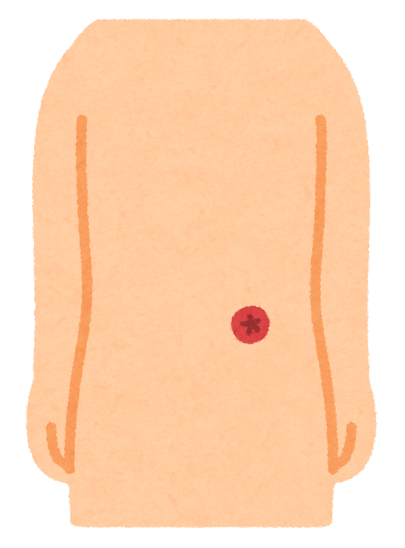 Gコミュニティ（潰瘍性大腸炎・クローン病）＆過敏性腸症候群向け情報発信 tweet media