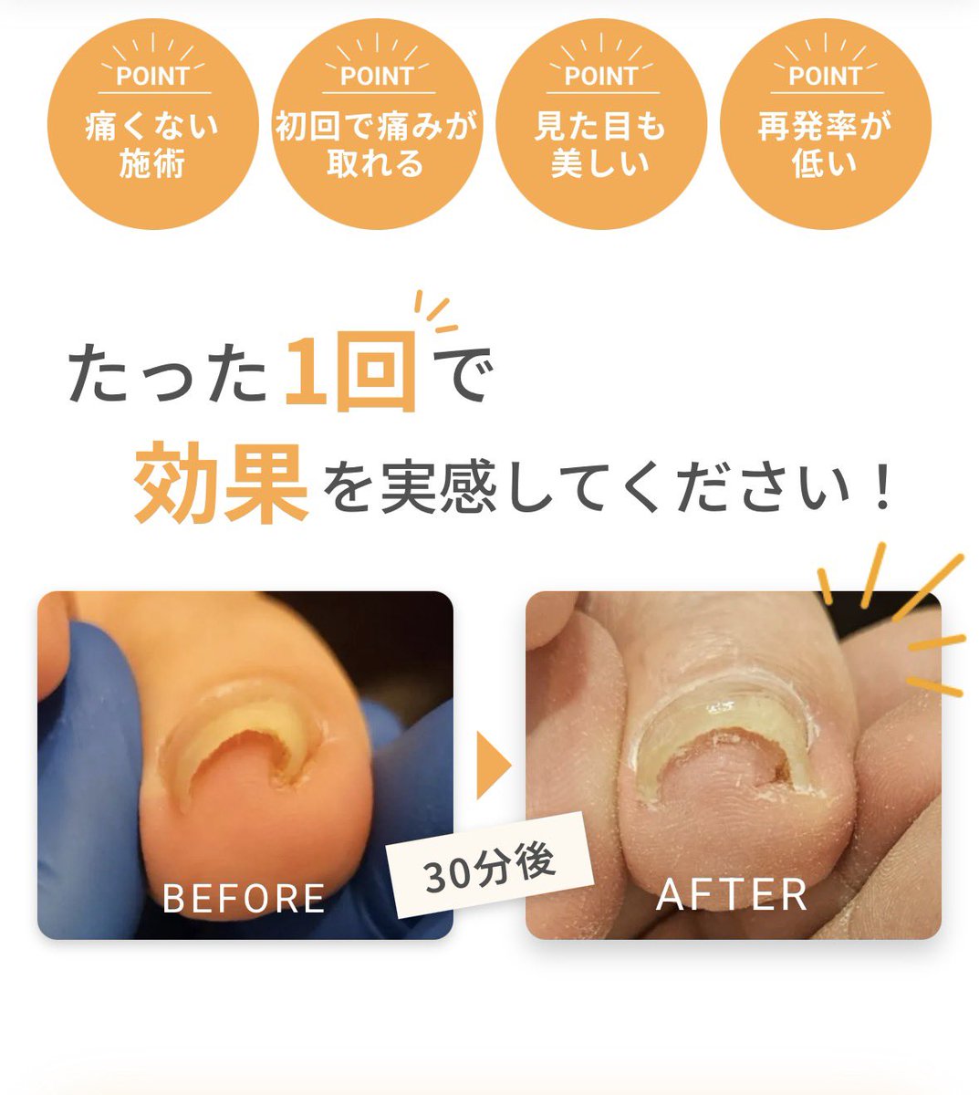自由が丘の巻爪と鍼灸治療院サロンQ tweet media