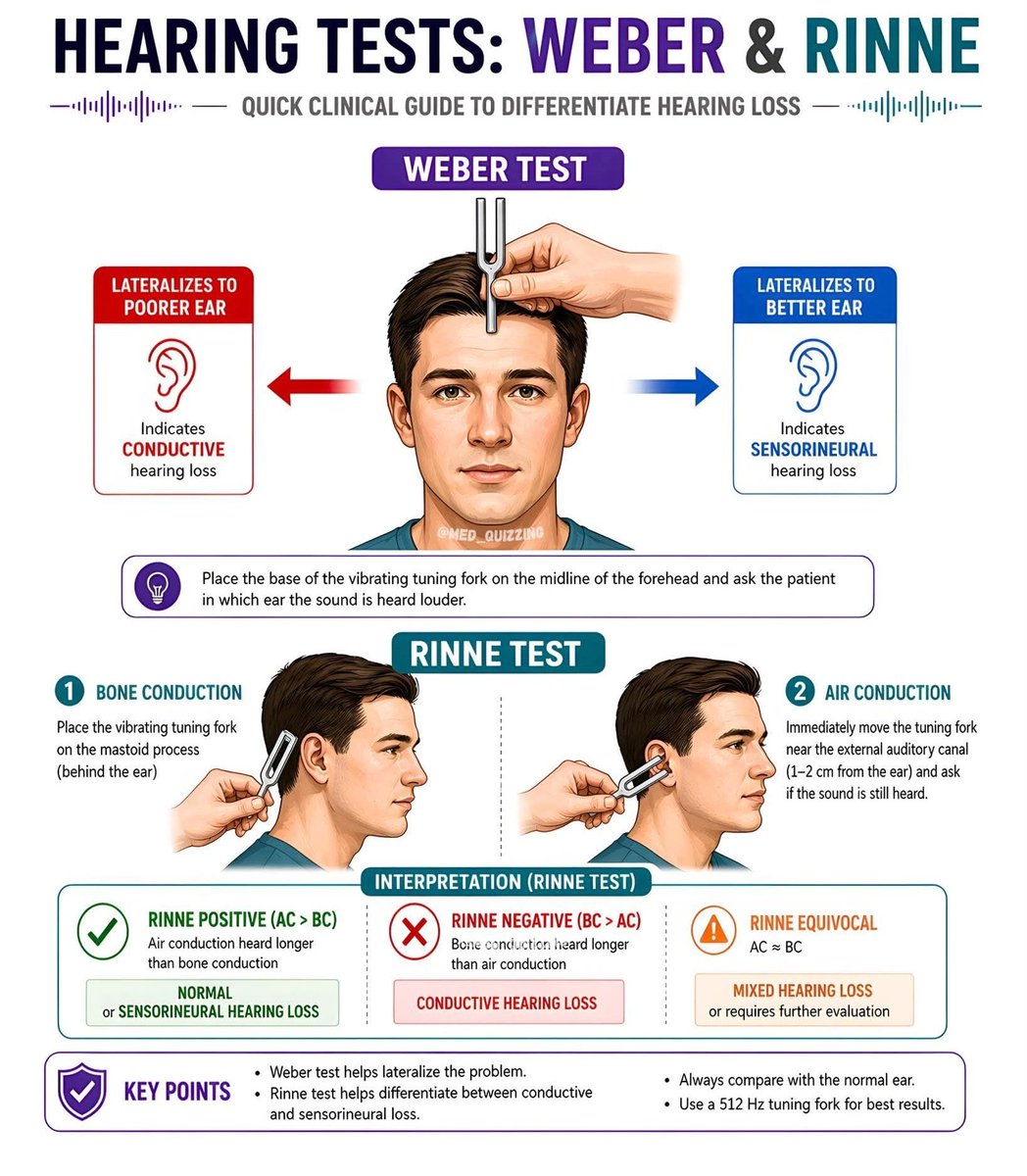 pgMedicine's tweet photo. Hearing tests 
Weber &amp; Rinne https://t.co/5KTZjQ7P76