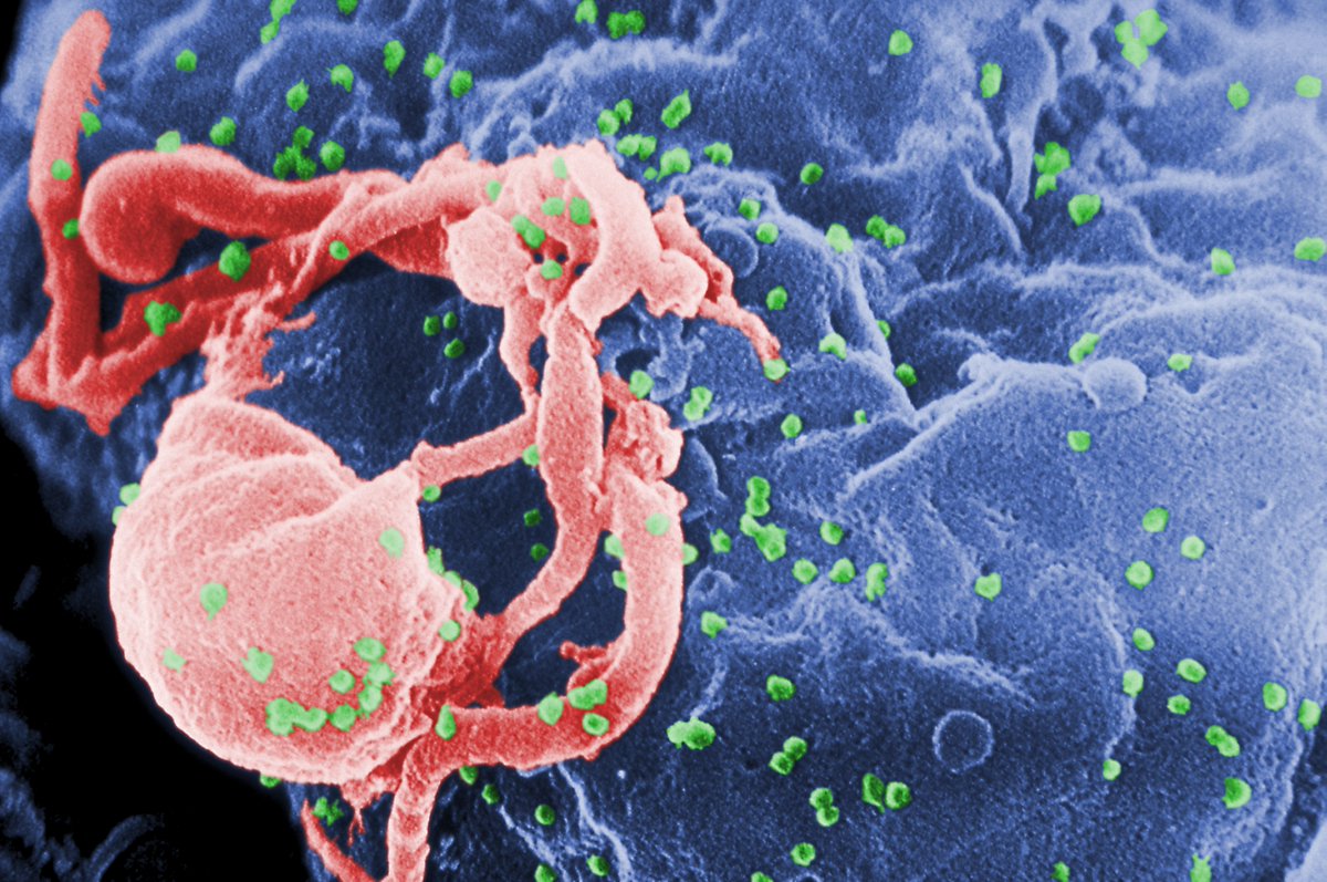 manuelacasasoli's tweet image. A functional cure for #HIV: Are we getting closer?

"A gene-therapy approach to thwart the #AIDS virus that has long struggled to gain traction may have new momentum after a study found it could “functionally cure” at least some monkeys."

#Science #Biology #Medicine #Health
⏯️ A