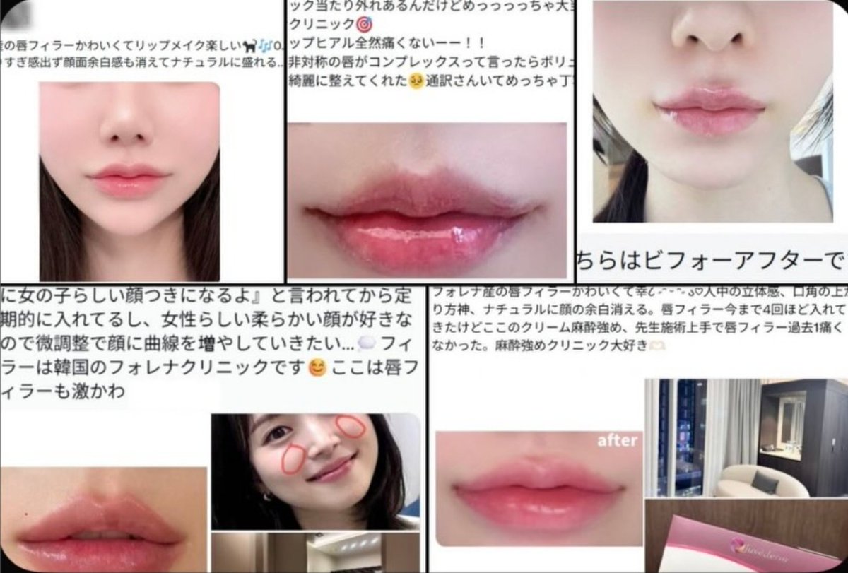 🤍フォレナクリニック公式アカウント🤍 tweet media
