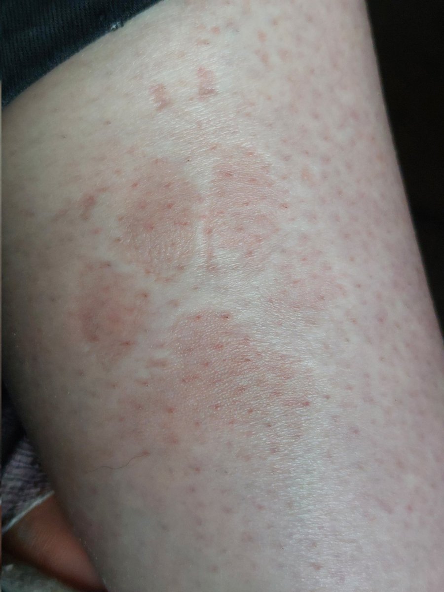 RuthvanZalinge's tweet image. Rapha literally leaving his paw prints on me!! #WFH
 If a human colleague was like this, it'd be "Hello HR"! 📞 🤣😉