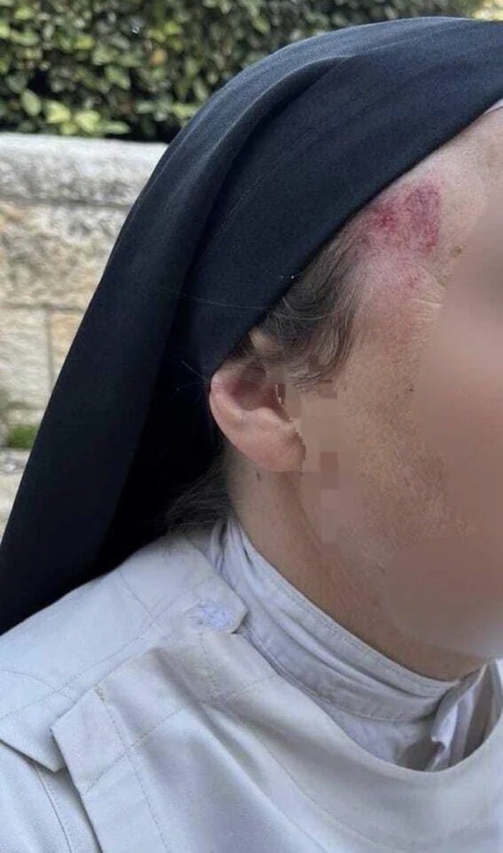 TonyOryan's tweet photo. وينو بسين طروادة، يلي عامل أسد الفدرلة والتقسيم وشادد ضهرو بمملكة ابستين، وينو من الإساءة للمسيح واهانة بابا روما وتكسير الصلبان والاعتداء على الراهبات والرهبان؟
مش معني، مشغول بالحسابات الوهمية والشعبوية وداير توزيع شهادات بالزعططة. https://t.co/ye9jNleD2G