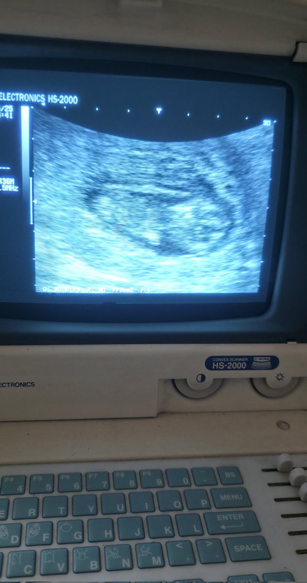 hooda_mahmoud16's tweet photo. 👋Hello everyone ... I urgently need $500 to buy medicine, food, and repair my tent. I've been appealing for help for days without success. 🙏 Please share. And donate if you can .. For the sake of my pregnant wife and my baby, bring some joy to us.🙏🙏🥹 https://t.co/jzEvsVjc1I https://t.co/WbXsMXT30d