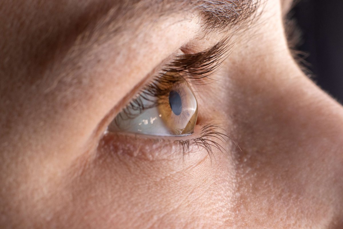 OptometricManagement tweet media