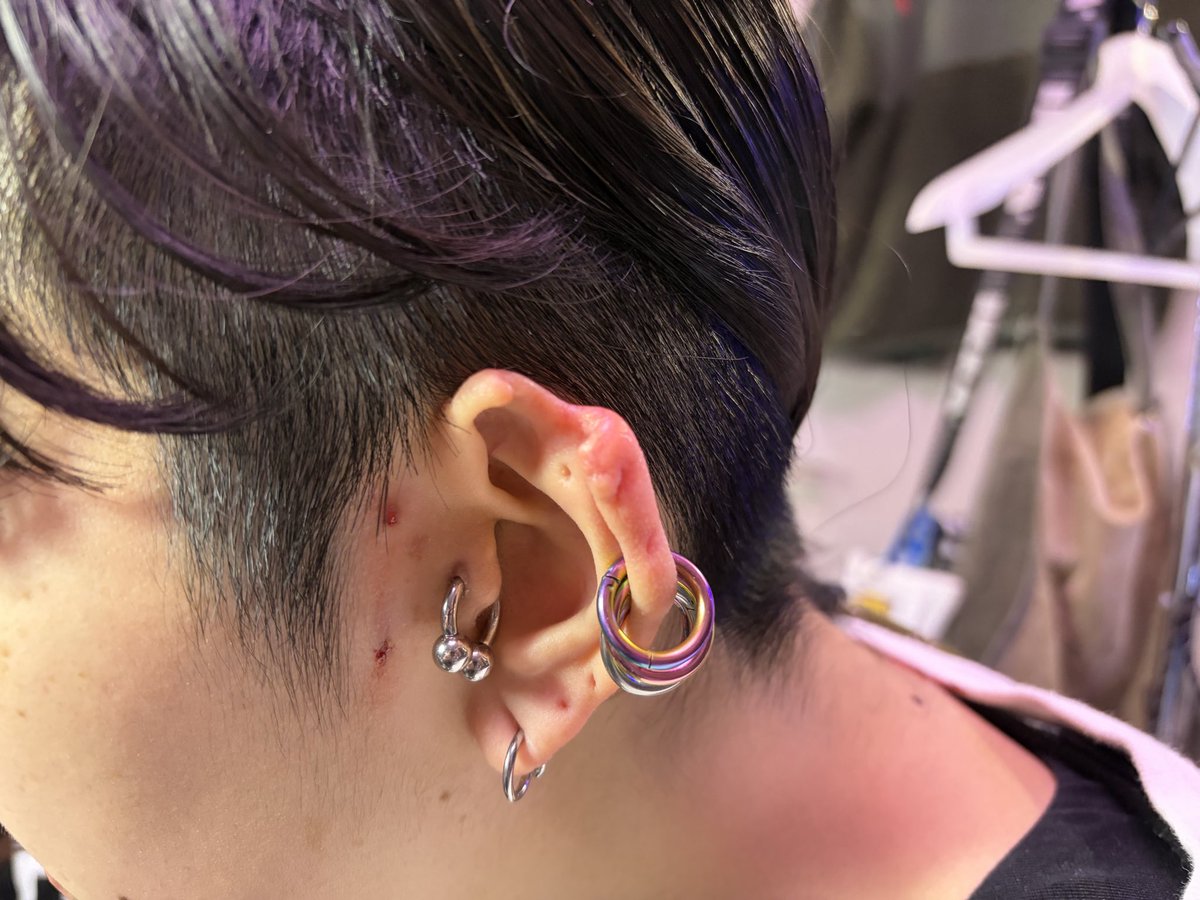 96Olver_pf's tweet photo. .
アンピュテーションの経過
治りいい感じ

#ピアス
#piercing
#ピアススタジオ
#アンピュテーション https://t.co/qWgLVr6y3J