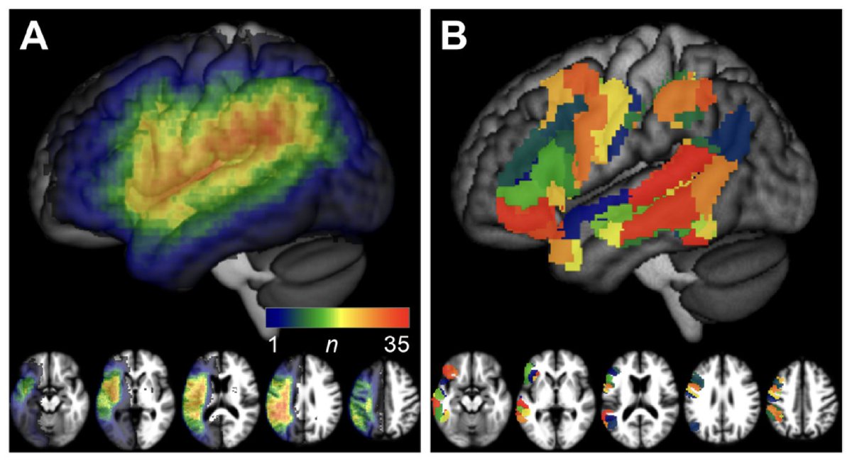 Imaging Neuroscience tweet media