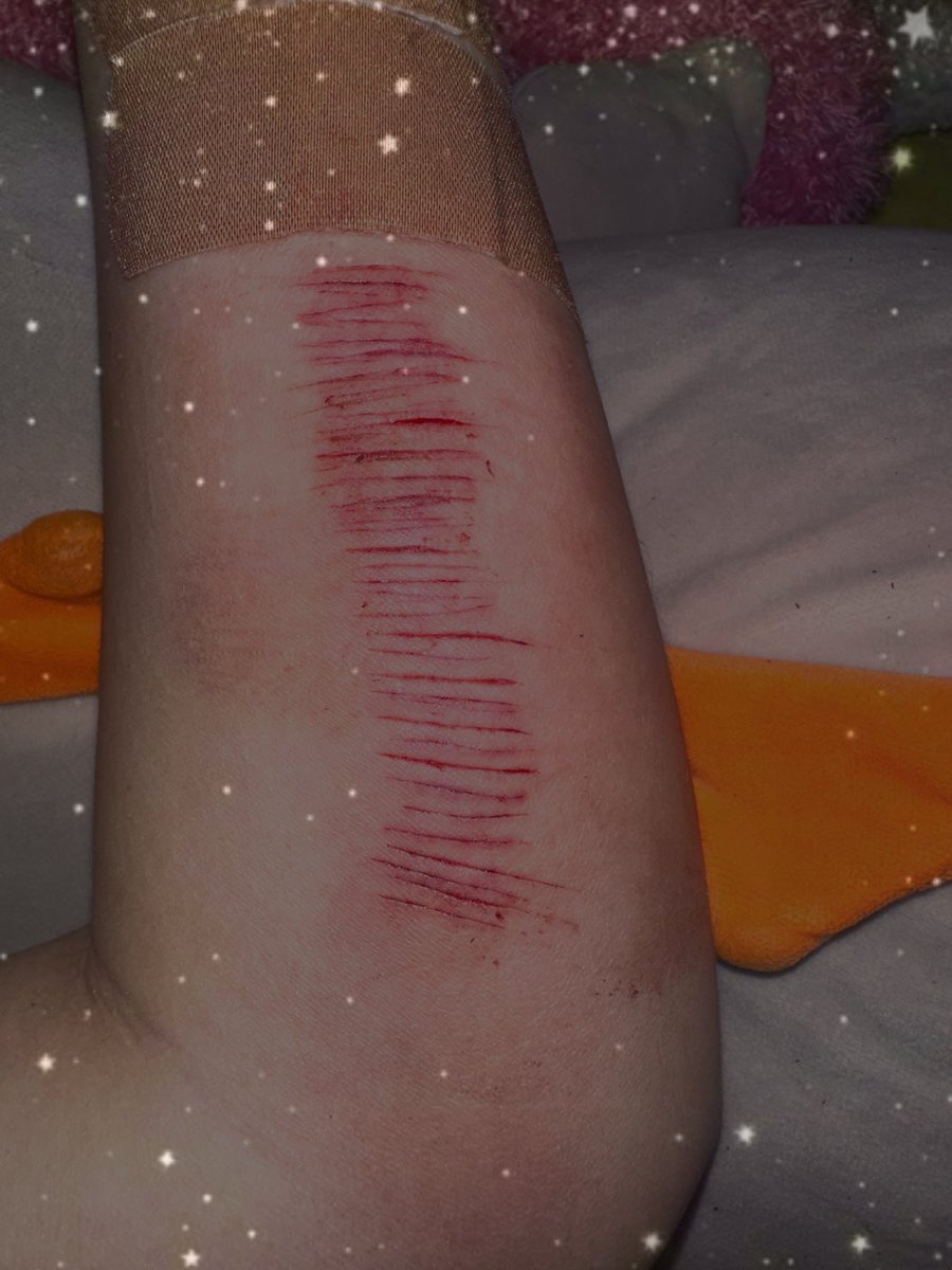 loafcatzz's tweet image. small sesh it’s hard to tell but there are a few styros ||ALL SFX FAKE BLOOD ALL MAKEUP || #shtwt #sh #styro #catscraches
