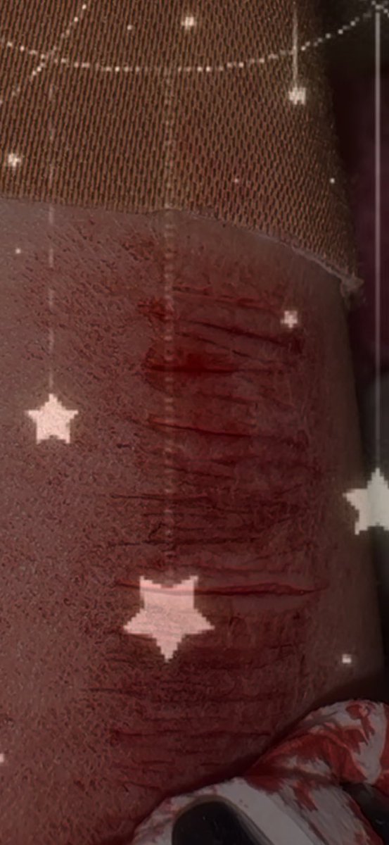 loafcatzz's tweet image. small sesh it’s hard to tell but there are a few styros ||ALL SFX FAKE BLOOD ALL MAKEUP || #shtwt #sh #styro #catscraches