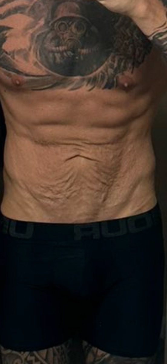 FrouJomo's tweet photo. @Alltheballsbets @ToonGrimey If your mom woulda stopped feeding you, you wouldn’t have this permanent melted wax of a stomach https://t.co/YnkIsO1gah